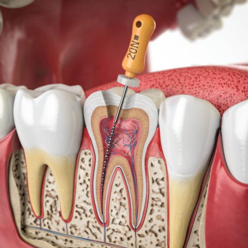 Endodontia