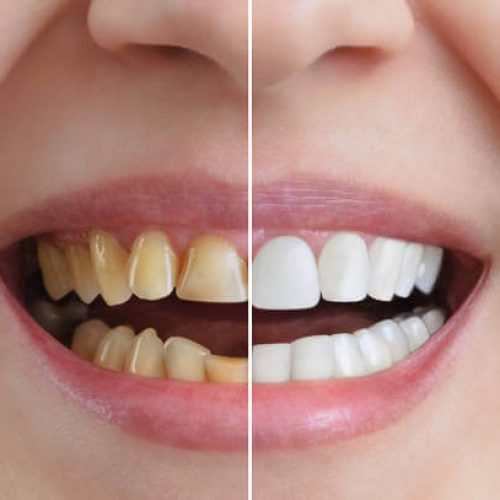 Estética dental